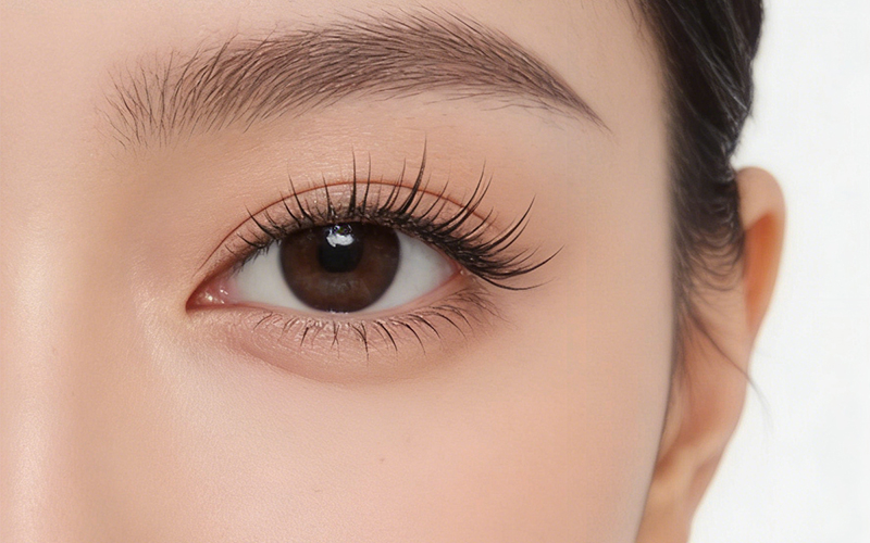 眼部综合整形示意